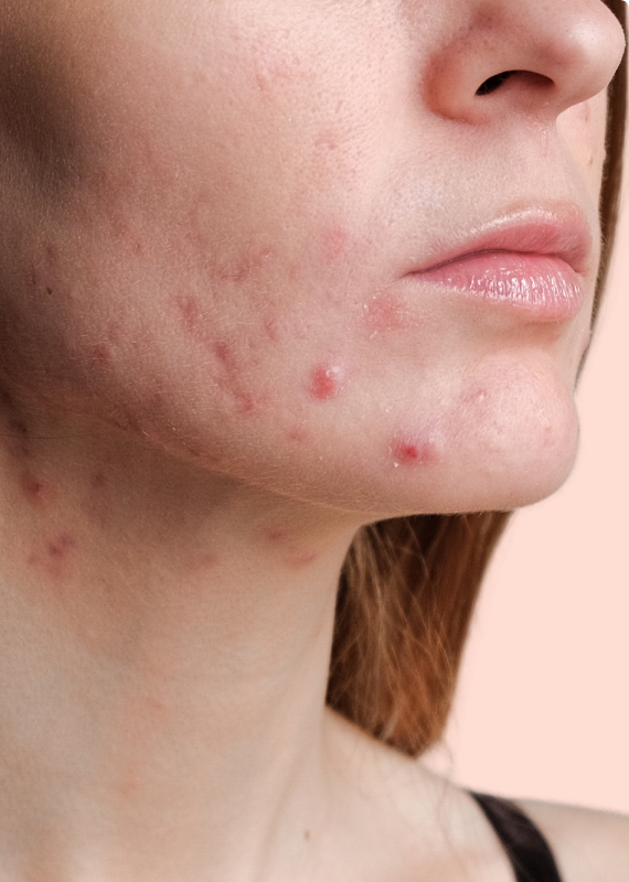 dermatologia Clínica